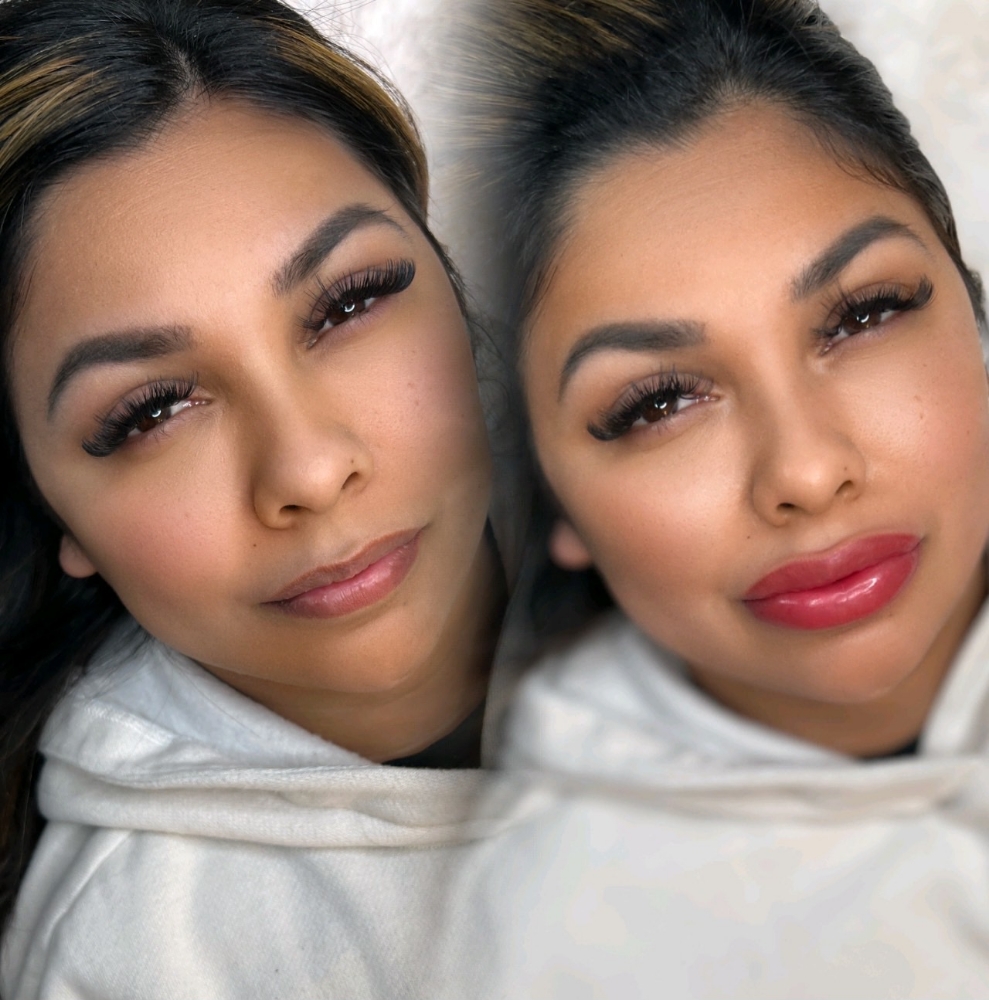 Dark Lips Neutralization
