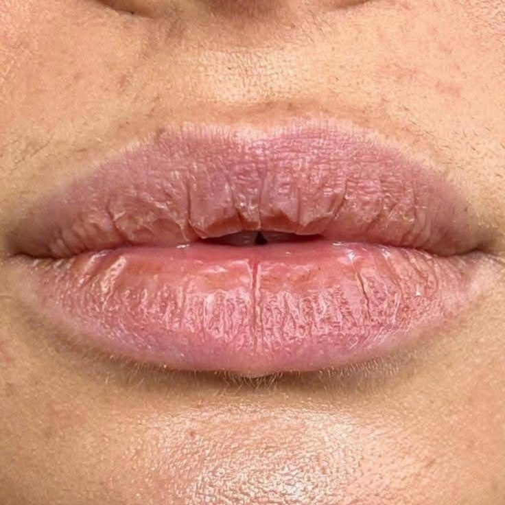 Lip Treatment at Luxe Royale Spa in Paramus, NJ