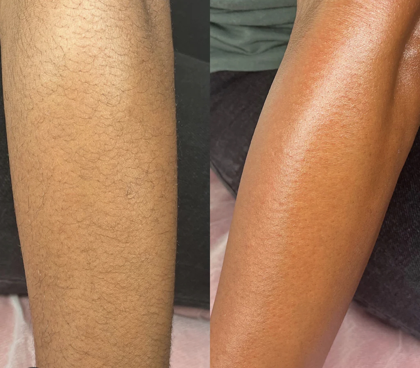 Half Arm
