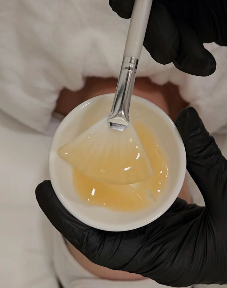 Multi Vitamin Chemical Peel at Ginnette Studio in Torrance, CA