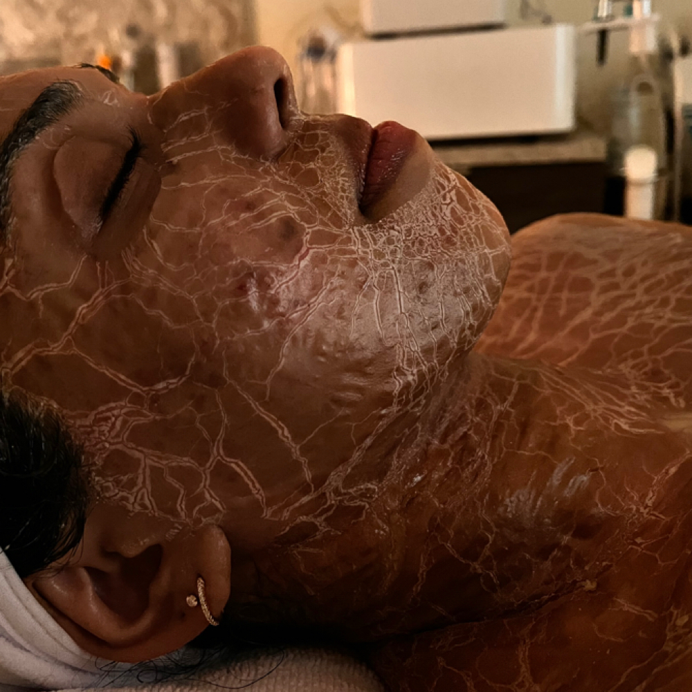 DMK Enzyme Therapy at The Bella Angel Glow in Farmingdale, NY