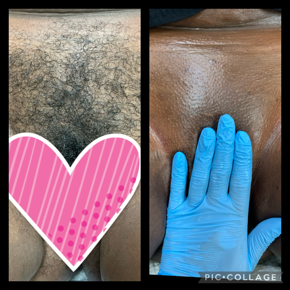 Brazilian Wax