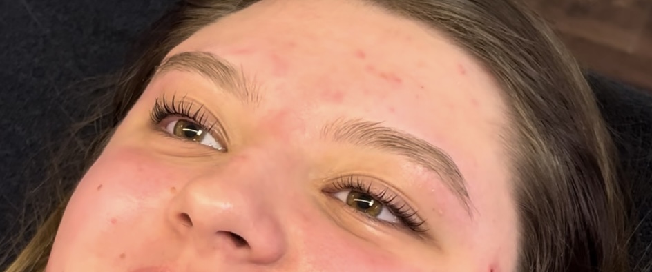 Brow Lamination at CDESTHETICS in McKinney, TX