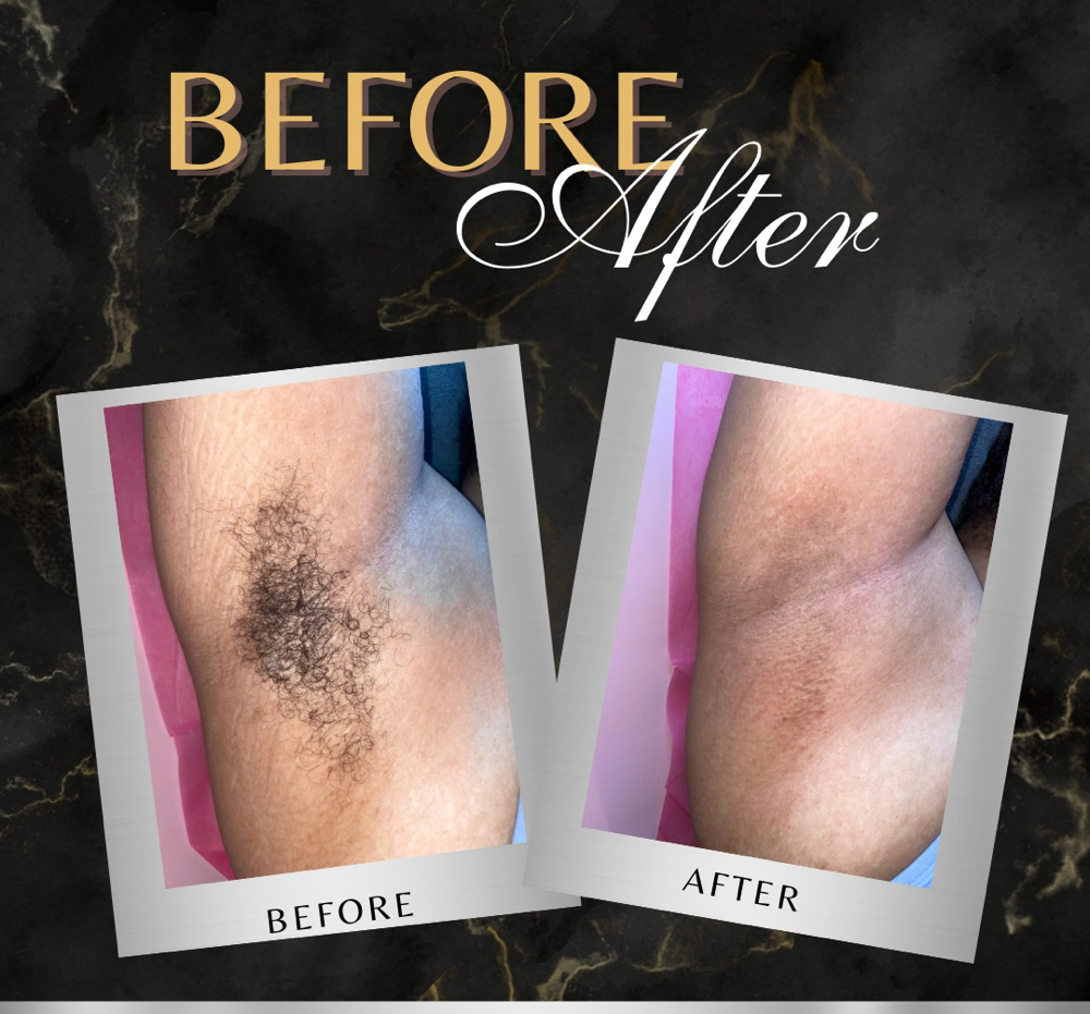 Underarm Wax