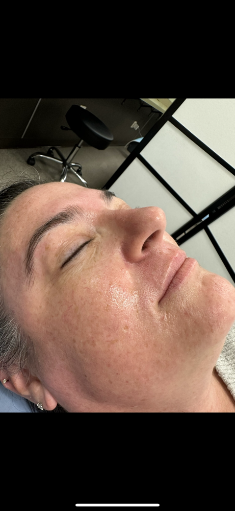 Full Face and Brow Wax