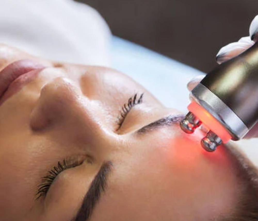 RF (Skin Tightening)-Face