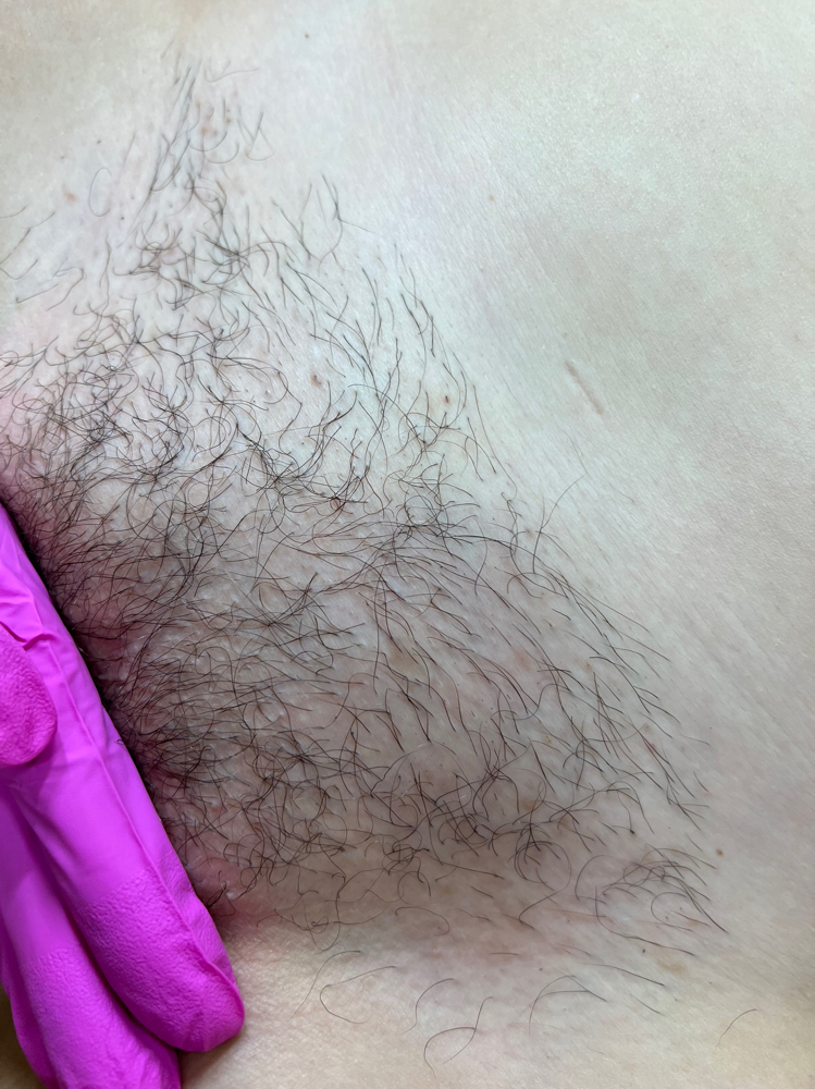 Waxing - First time Bikini/Brazilian-male or female anatomy