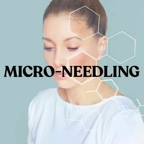 Micro-Needling