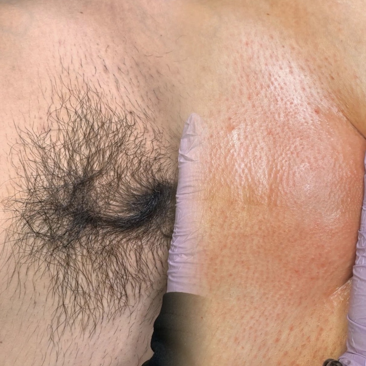 Brazilian at JBeauty & Blinks— Esthetics by Jacey Brosious in Colorado Springs, CO