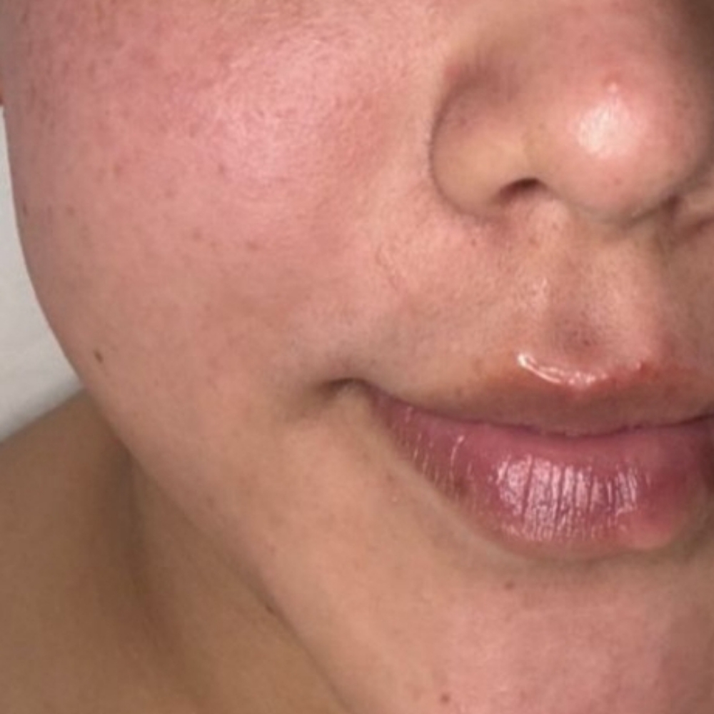 Lip/Chin wax at Midtown Esthetics in Raleigh, NC