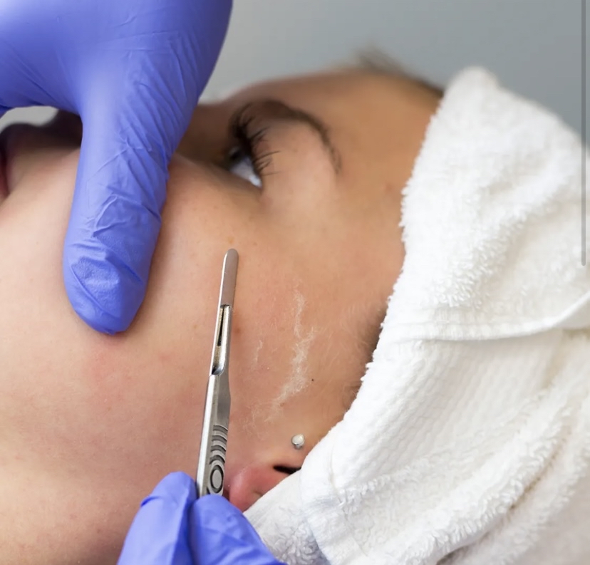 Delux Dermaplaning Facial