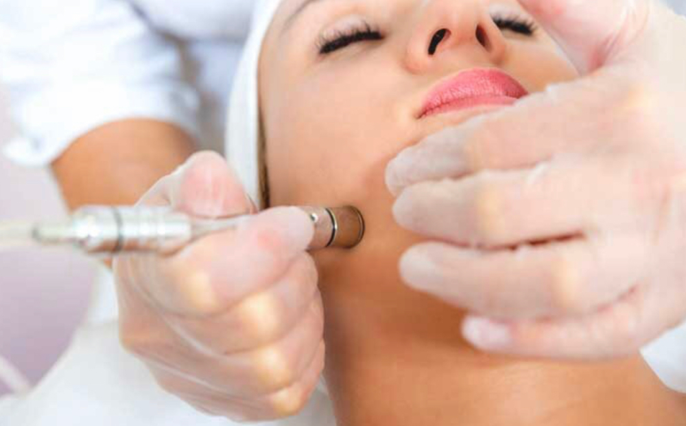 Microdermabrasion Add-On