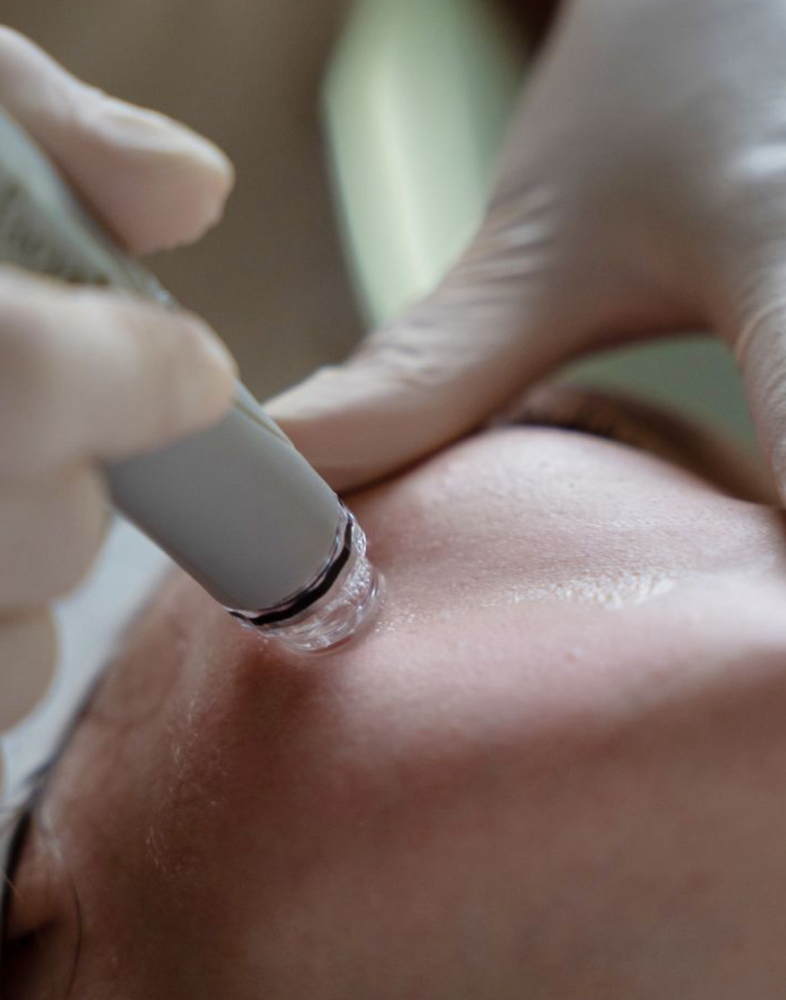 Hydra Facial
