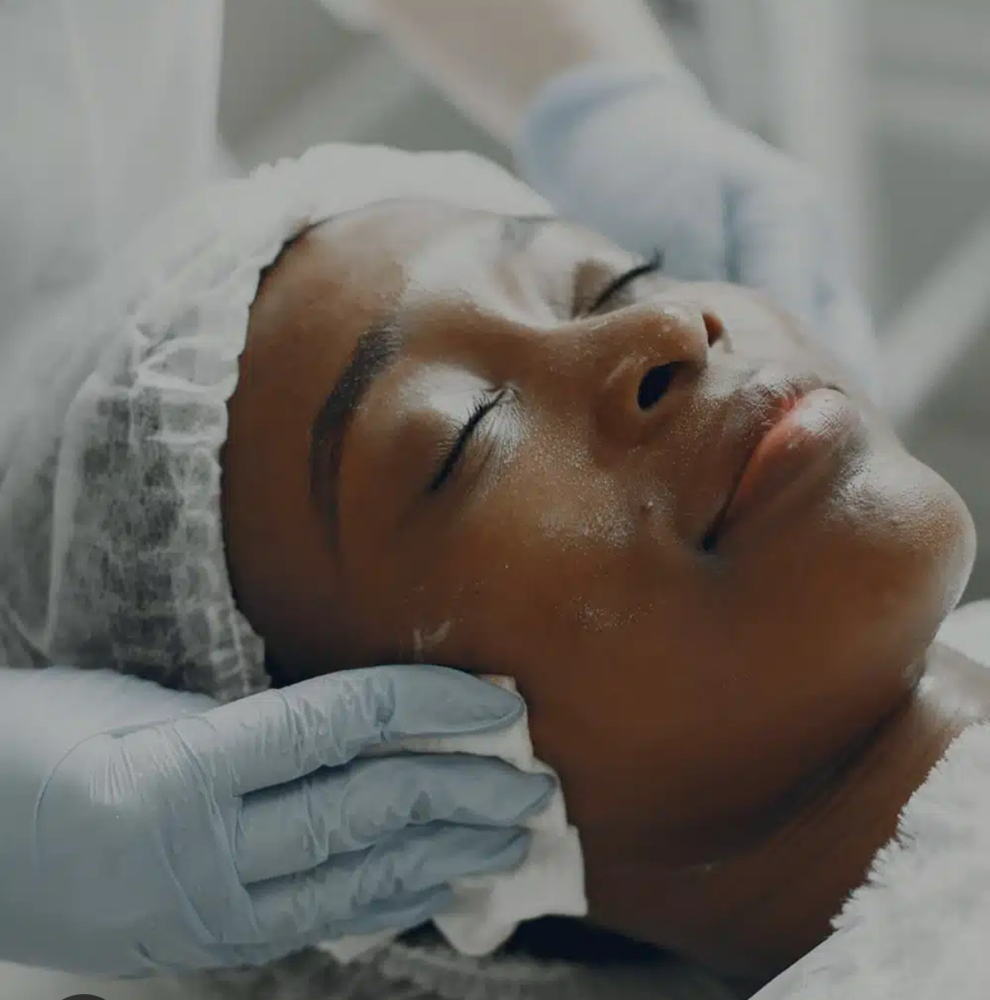 Acne Spot Treatment