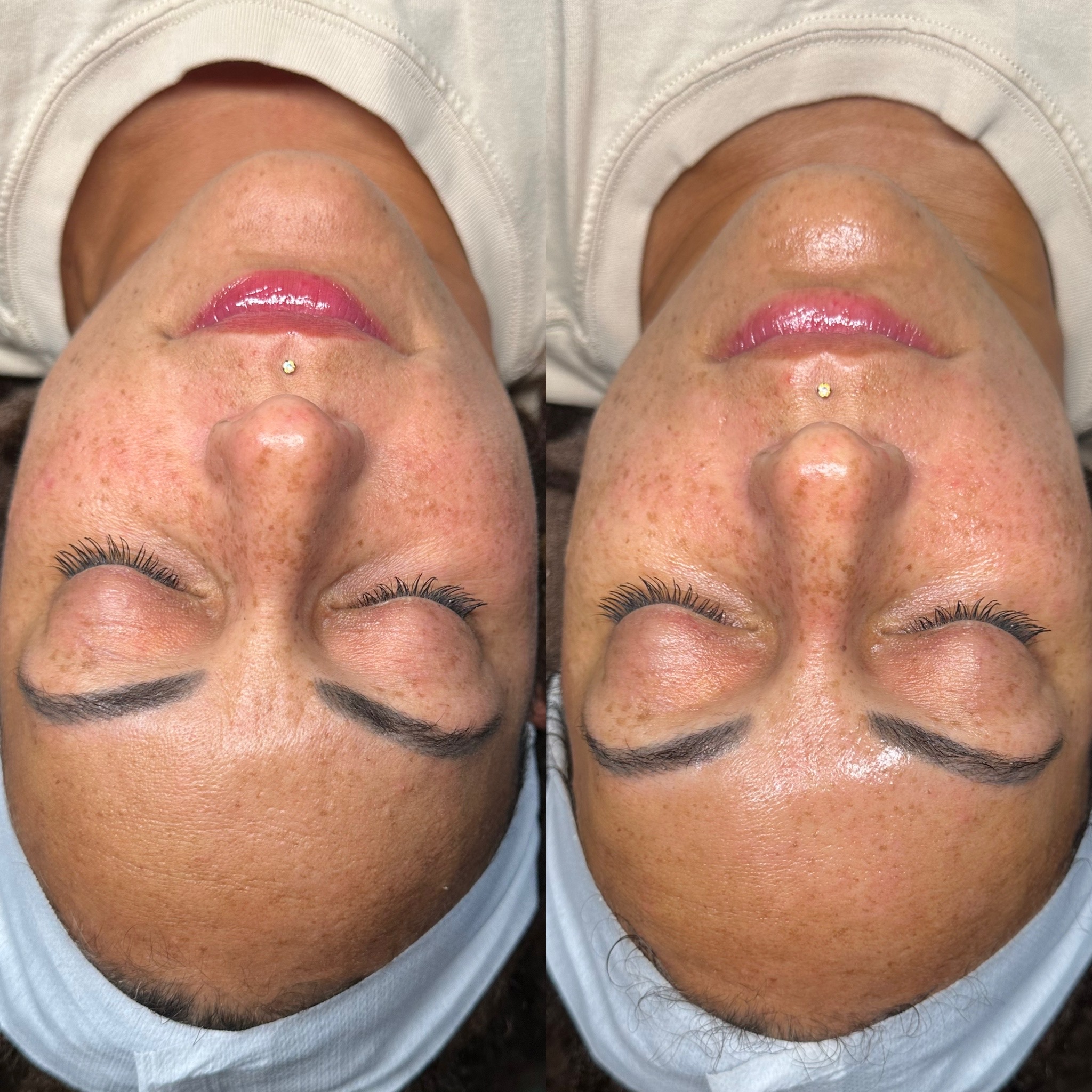Signature Glow Peel