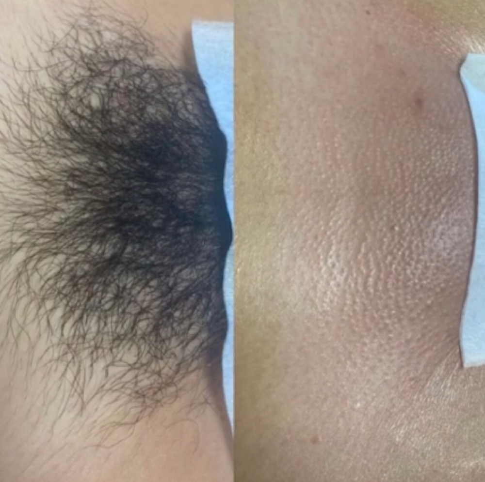Brazilian Wax 1st Visit ! at Sacred Lotus Collective LLC in Chandler, AZ