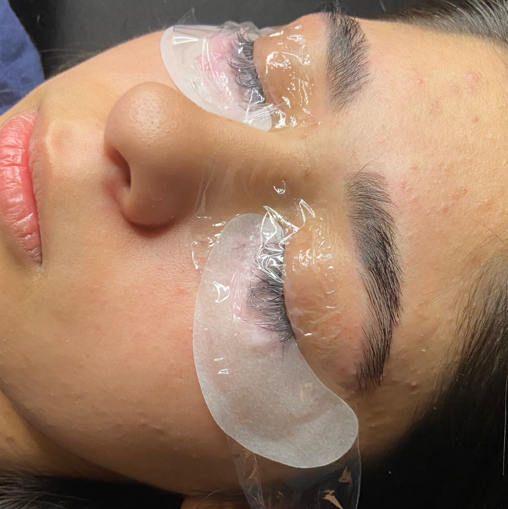 Lash Removal.