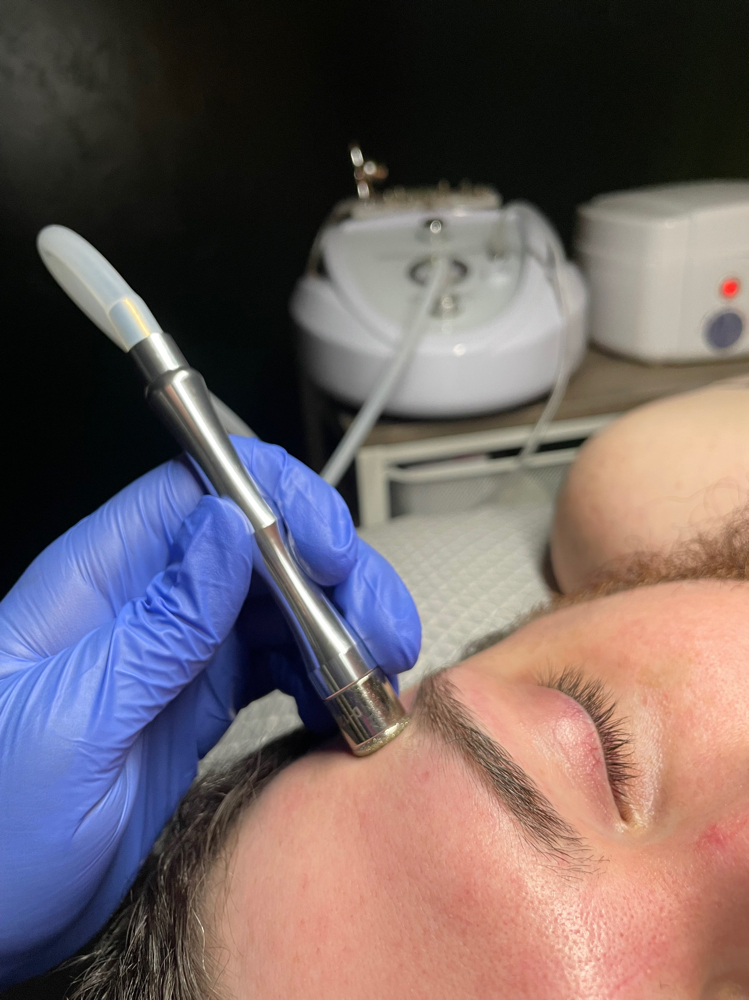 Microdermabrasion Facial