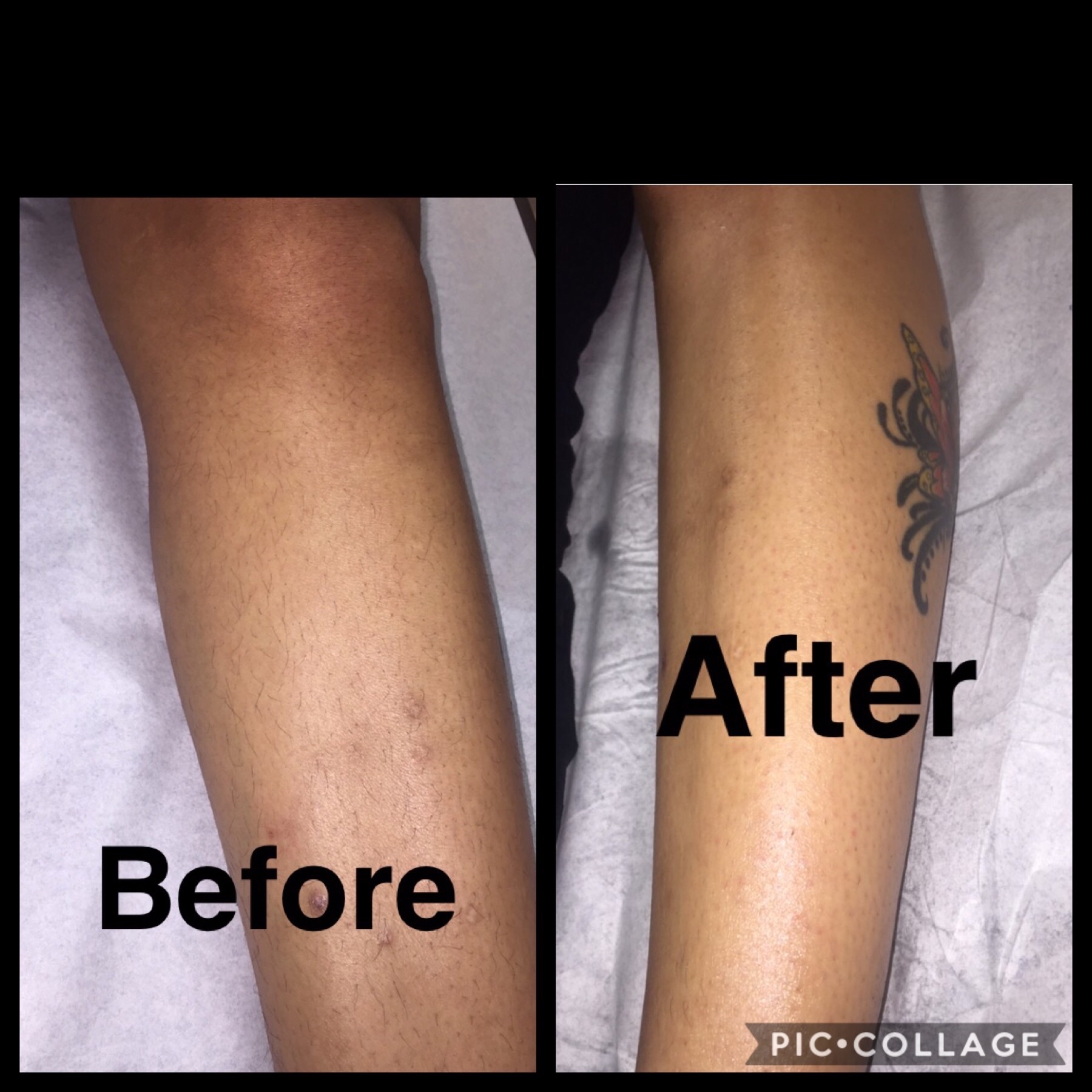 Full Leg Wax