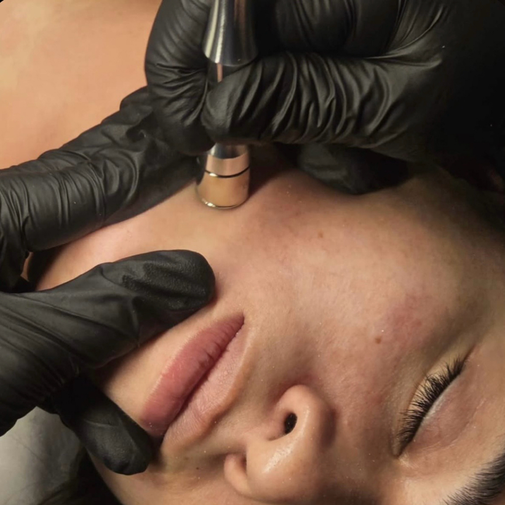 Microdermabrasion at HisImage Esthetics in Loganville, GA