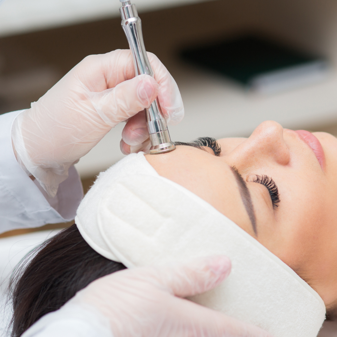 MICRODERMABRASION FACIAL at Here She Glows Spa in Agoura Hills, CA