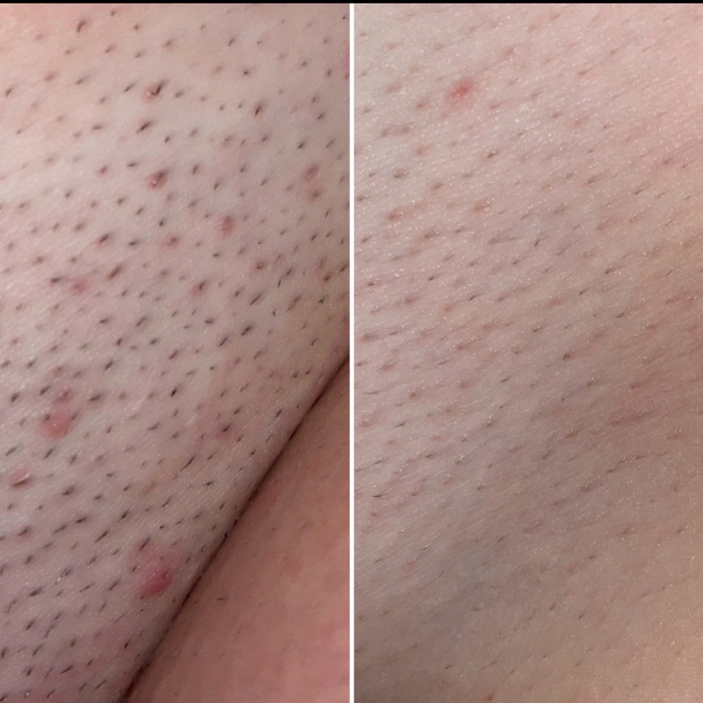 Rescate de Vellos Encarnados + Depi at Tayselfcarestudio LLC in Lawrence, MA