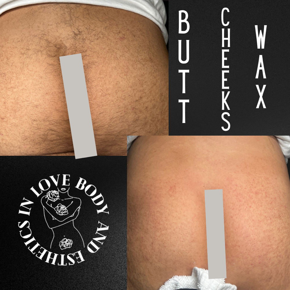 Waxing- Buttcheeks