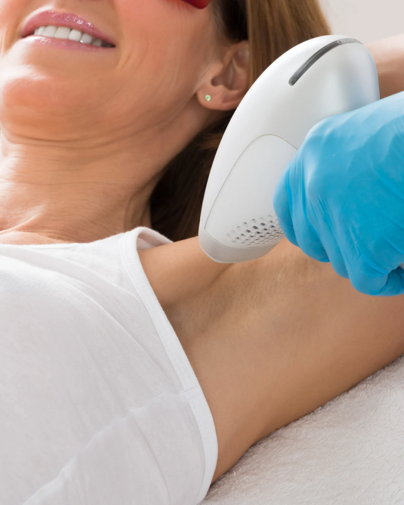 Underarms Laser Hair Removal at M.A.V Aesthetics in Fort Morgan, CO