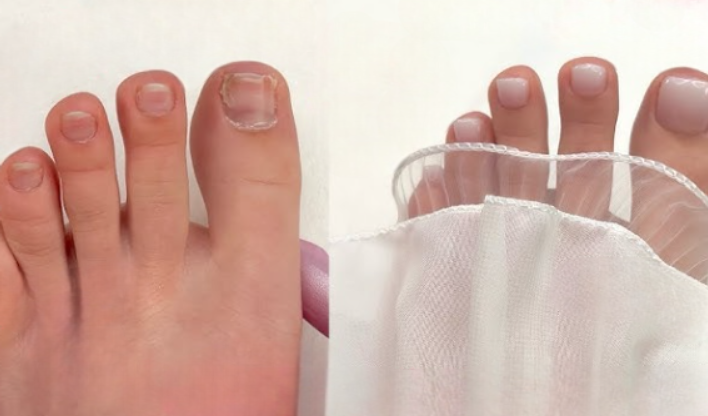 Gel X for Toes