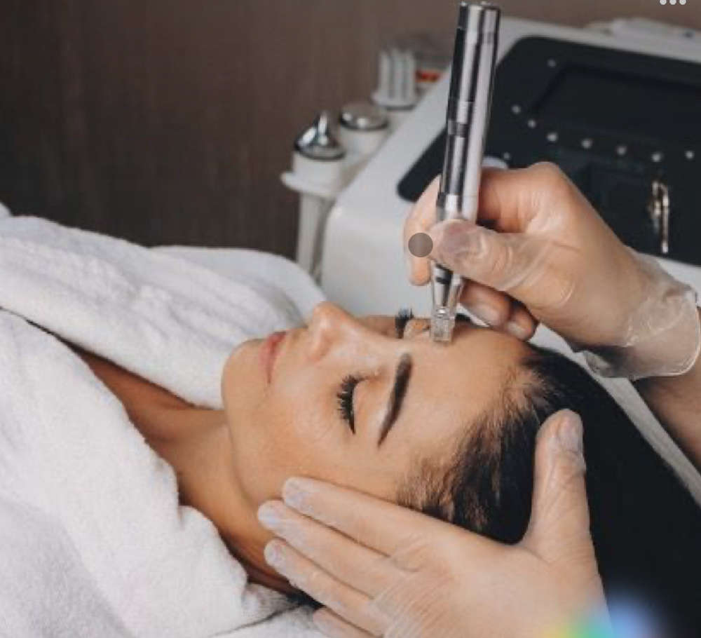 Microdermabrasion Facial