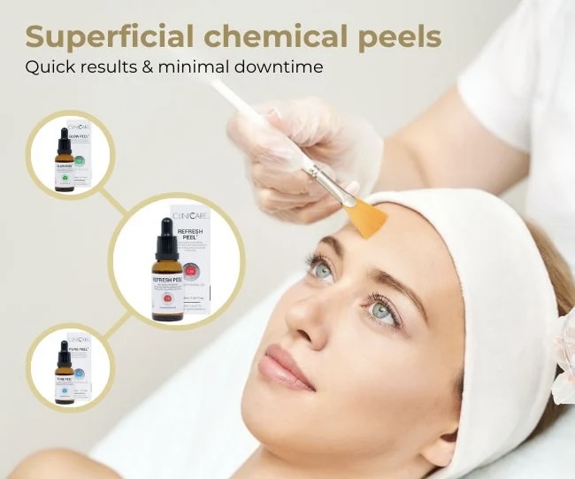 Superficial Chemical Peel Facial