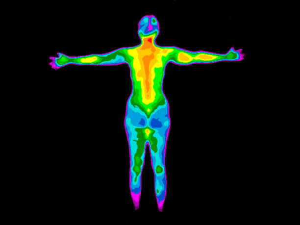 Thermography