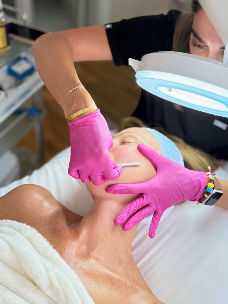 Dermaplane ADD ON