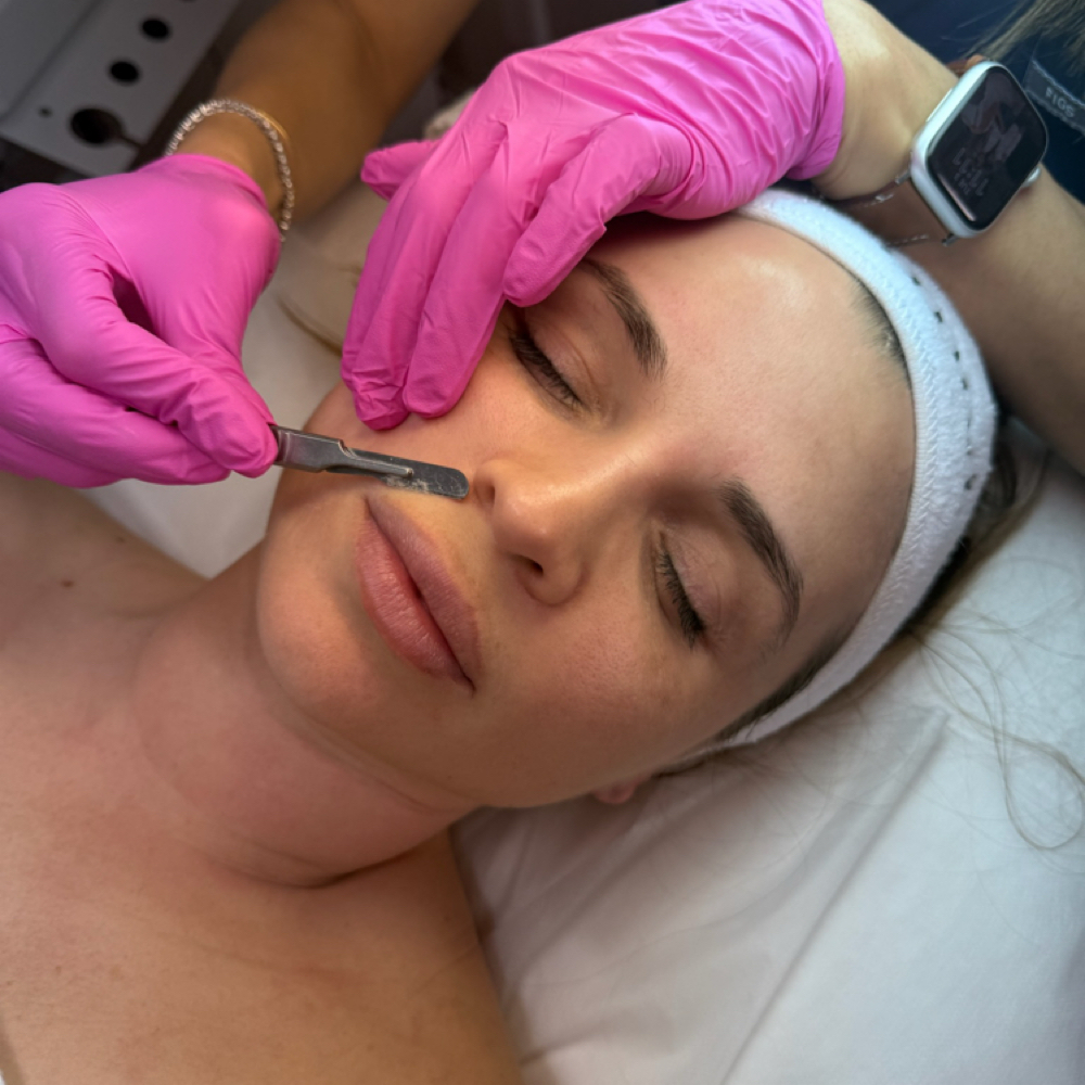 Dermaplane ADD ON at DermAdi Skin in Houston, TX