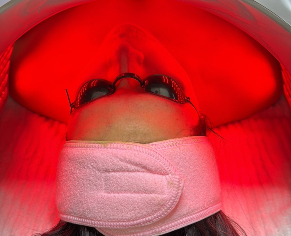 Luminous Lift (Ultratherapy Light)