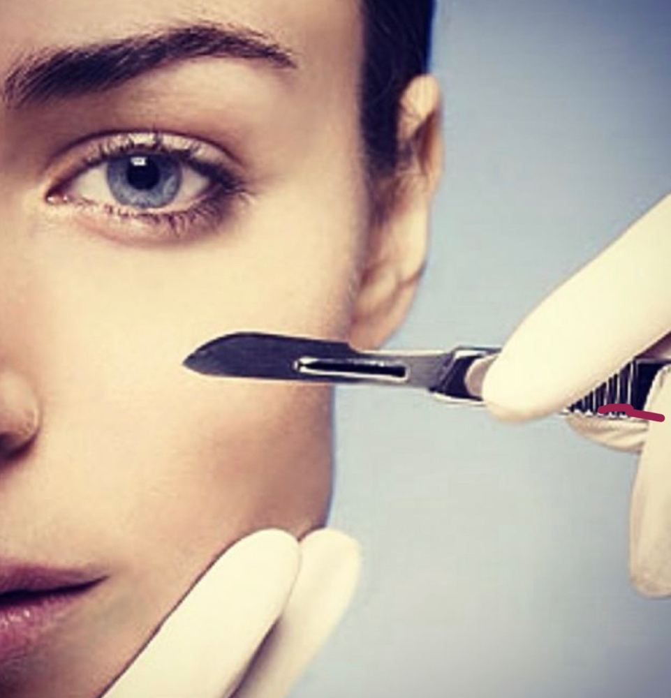 Dermaplaning