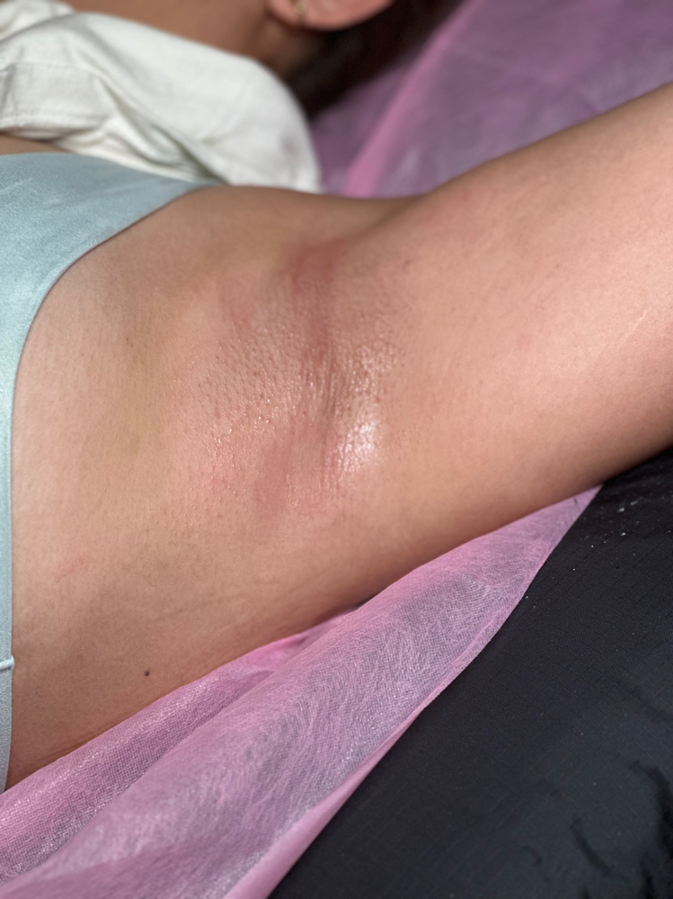 Sugaring/Underarm