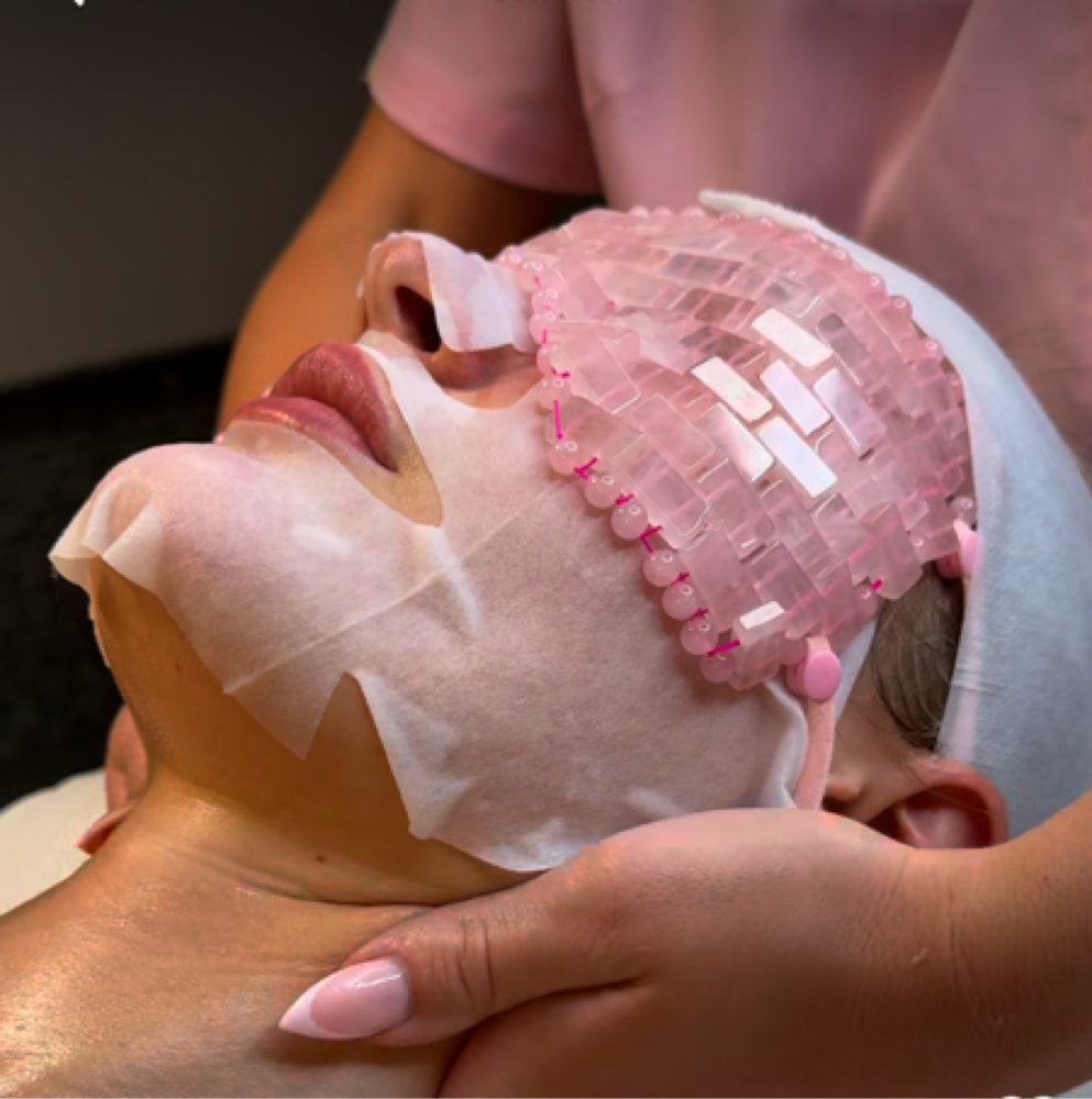 Microneedling Face/Neck/Décolleté at Lace Skn in West Lake Hills, TX