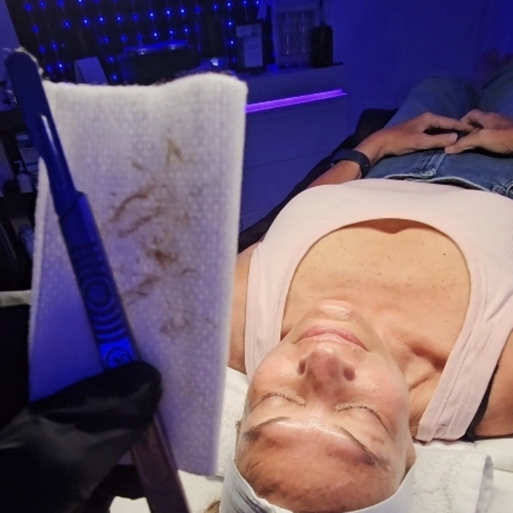 The Dermaplane Facial at LexGlo Esthetics in Idaho Falls, ID