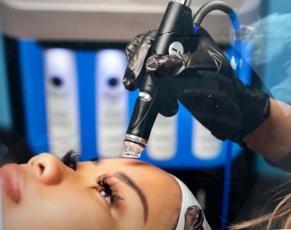 Hydrafacial