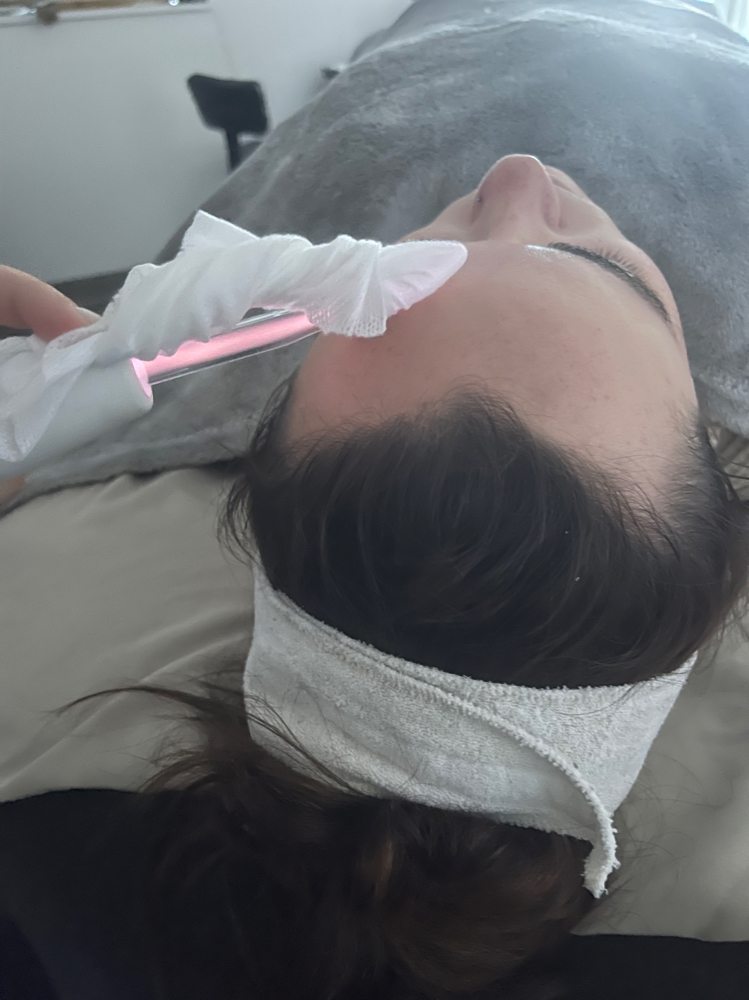 Acne Detox