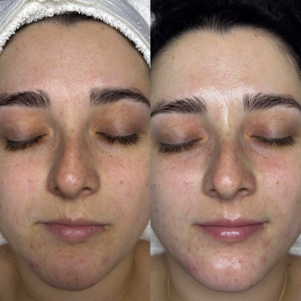 Basic Facial at Heavenly Skin Spa in Shorewood, IL