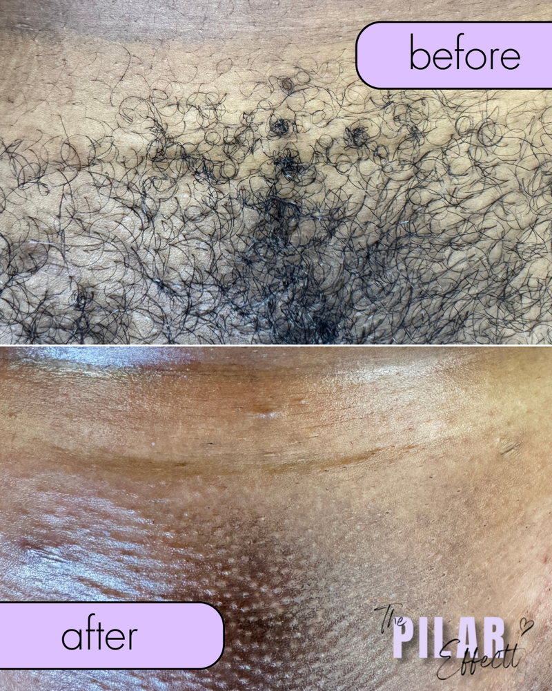 Brazilian (Existing Client)