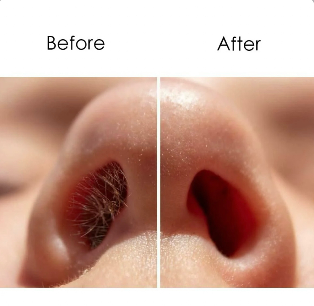 Nose Wax