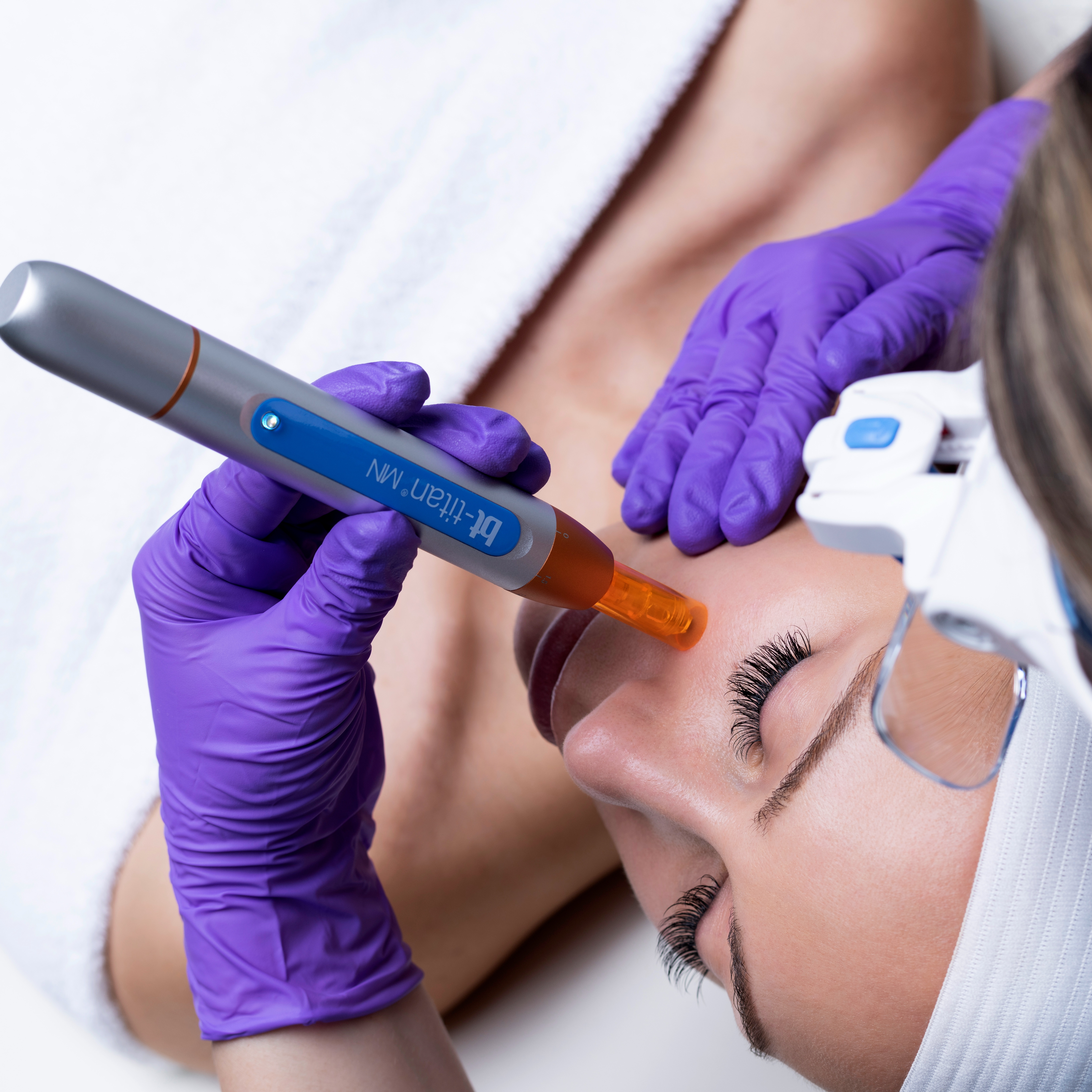 Micro-Channeling w/ Growth Factors