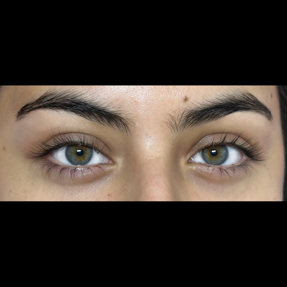 Lash Lift