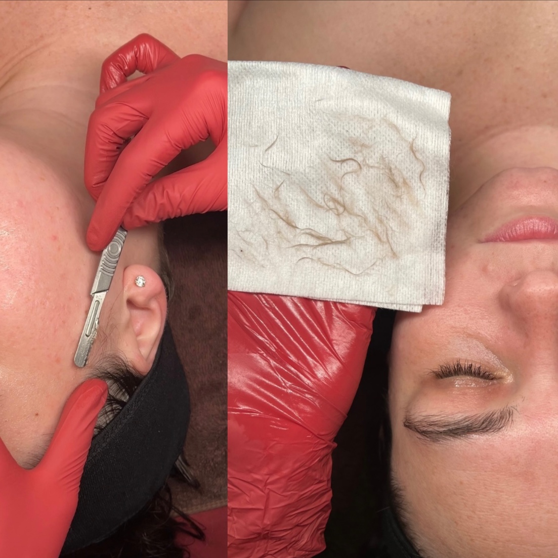 Dermaplaning Facial🌻 at Soulsthetics in Jacksonville, FL