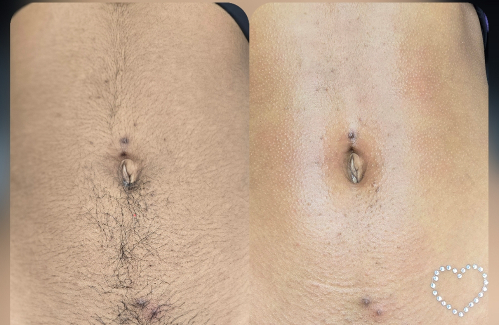 Women’s Stomach Wax