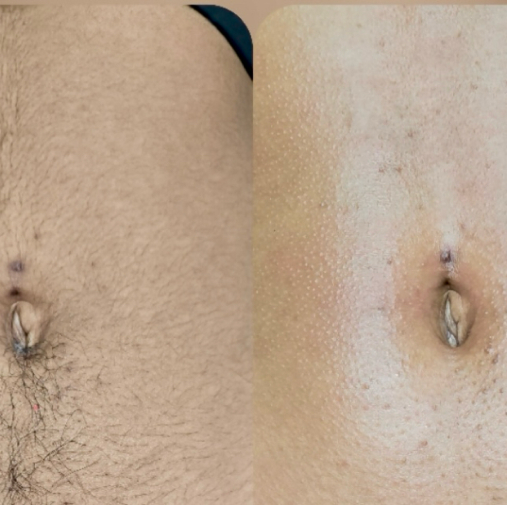 Women’s Stomach Wax