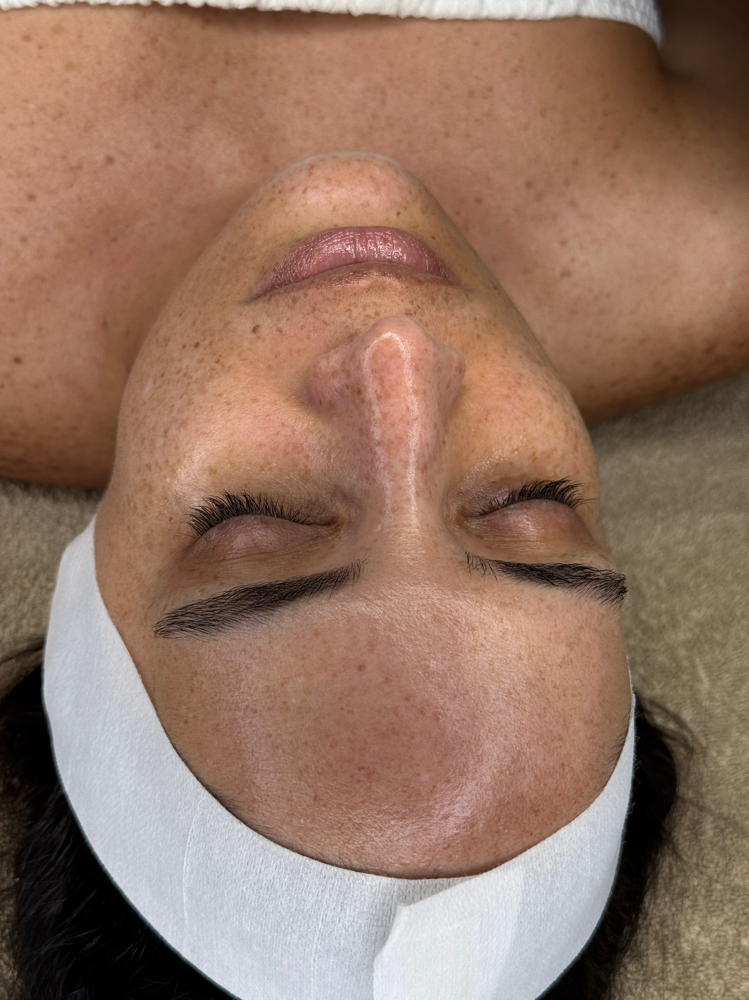 Salmon DNA Glow Therapy at Mila Wellness Center in Doral, FL